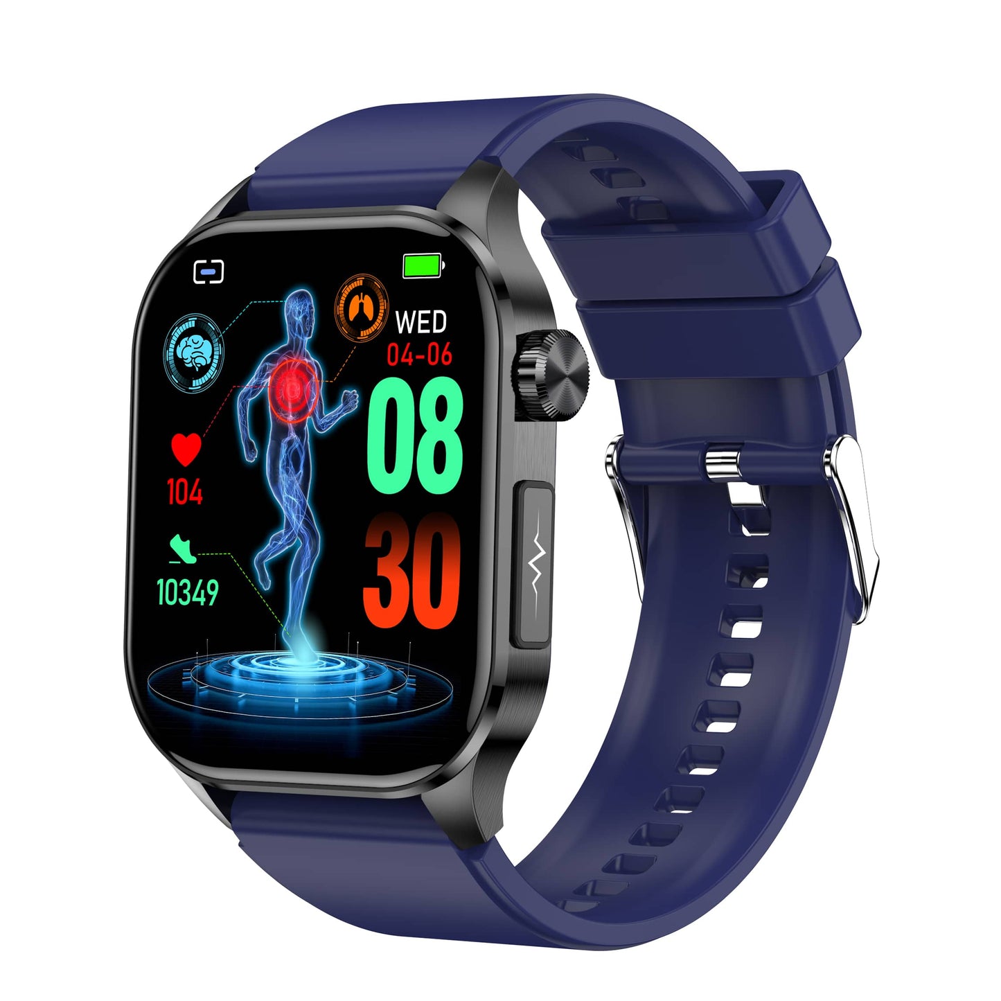 Zleganz EKG/EKG Blutzucker Blutdruck Anruf Intelligentes Gesundheitsmanagement Smart Watch