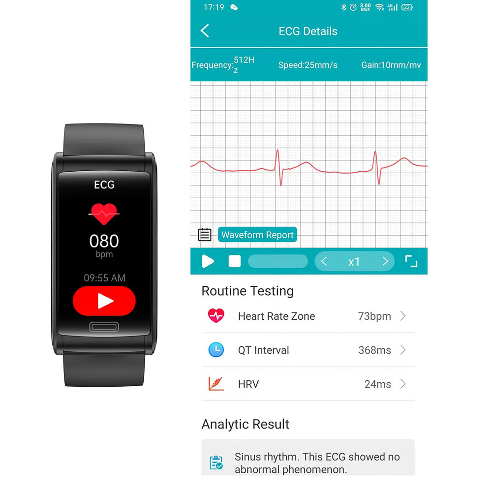 BCBEARSCOME BCE600 3-Kanal-EKG HRV Blutzucker Blutdruck Blutsauerstoff Schlaferkennung HD Bluetooth Smart Armband